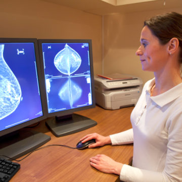 Manipulating molecules to enhance breast cancer treatment