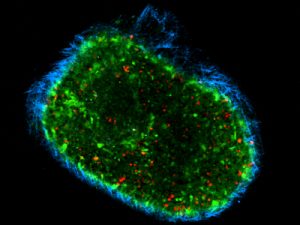 ex tumour immune cells