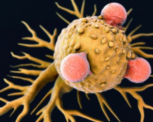 New research study explains how cancer cells resist treatment