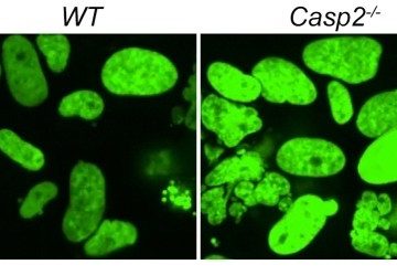 An enzyme with the capacity to suppress cancer growth