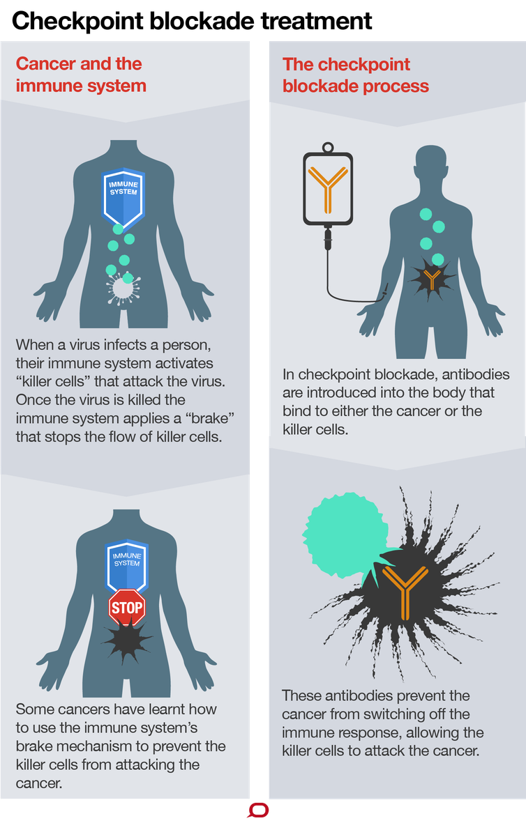 immunotherapy for prostate cancer australia)