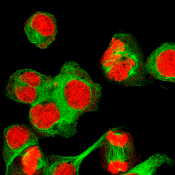 ‘Cellular barcoding’ reveals how breast cancer spreads