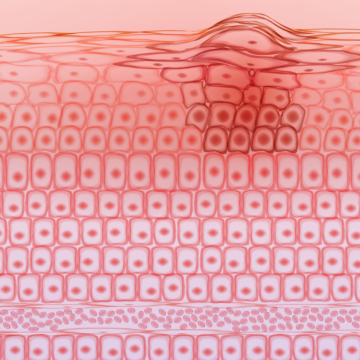 The bigger picture: Balancing innovation and evidence in the fight against melanoma